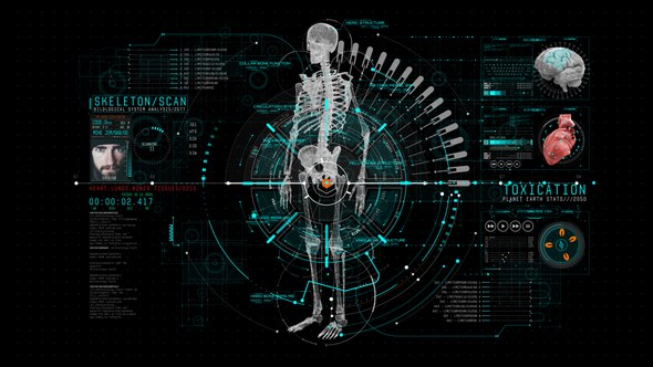 Videohive HUD Info Medical 1 Elements template preview