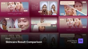Videohive Intro/Opening - Skincare Result Comparison After Effects Project Files Product Promo template preview