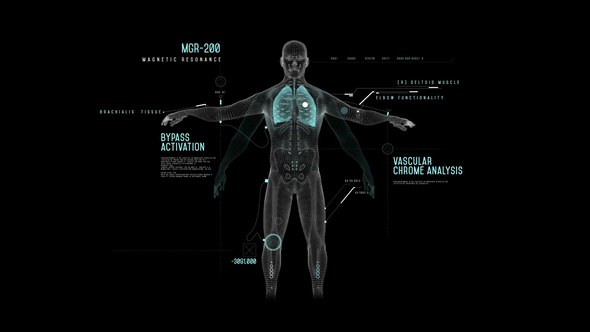 Videohive HUD Magnetic Resonance Infographics template preview