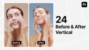 Before and After Instagram Stories Premiere Pro template preview