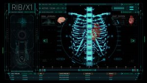 Videohive HUD Medical Ribs Elements template preview