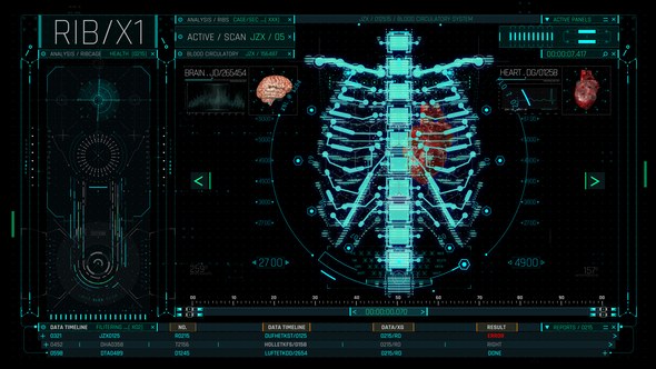 Videohive HUD Medical Ribs Elements template preview