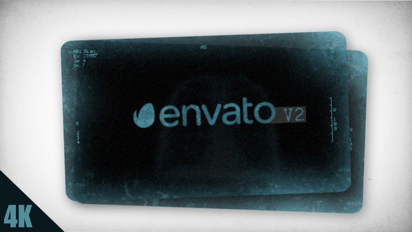 Videohive X-Ray Medical Pack Openers template preview
