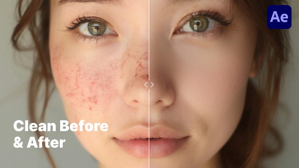 Videohive Minimalistic & Clean Before & After Comparison вЂ“ Premiere Pro Template Video Displays template preview