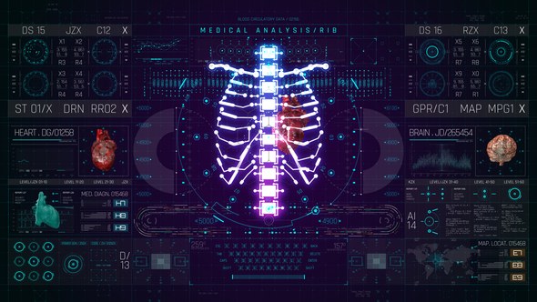 Videohive HUD PRO Medical Ribs Elements template preview