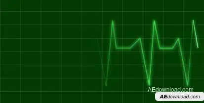 EKG Video Displays template preview