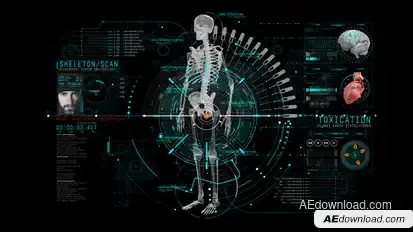 HUD Info Medical 1 Elements template preview