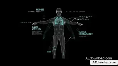 HUD Magnetic Resonance Infographics template preview
