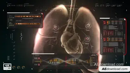 HUD Medical Pack Elements template preview